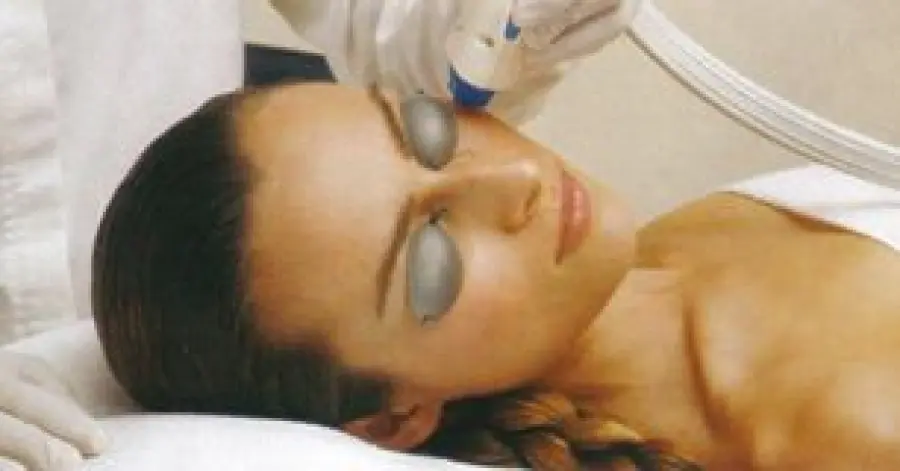 Couperose (cuperosi): macchie rosse viso e capillari. Creme, luce pulsata e trattamenti laser