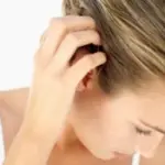 Sintomi psoriasi e cura: macchie rosse (eritema) della pelle e del cuoio capelluto