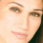 Filler viso con piastrine per eliminare le rughe: basta un prelievo del sangue 