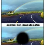 Degenerazione maculare dell' occhio: oscuramento del centro del campo visivo. Cura degenerazione maculare