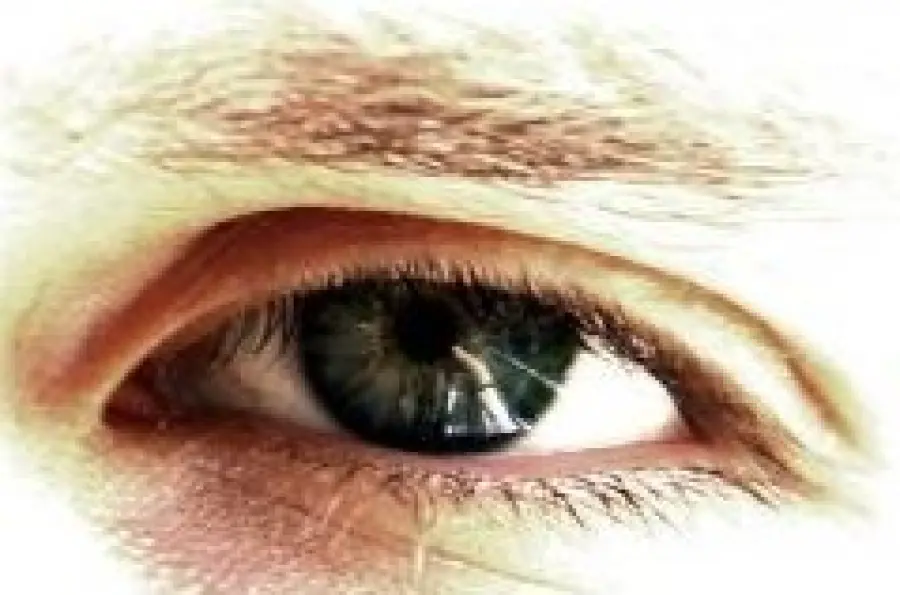 Sintomi cataratta occhio: vista annebbiata. Cura cataratta: intervento chirurgico sicuro