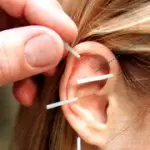 Auricoloterapia: smettere di fumare, controllo fame nervosa, cura mal di testa cronico, insonnia