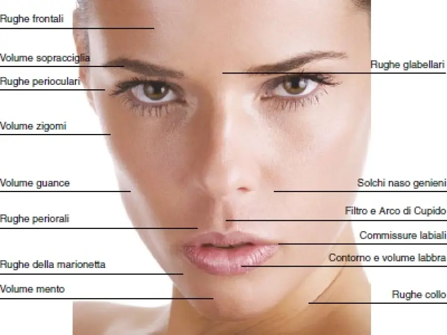 Acido iarulonico viso: filler antirughe e per dare volume agli zigomi-Medicina Estetica