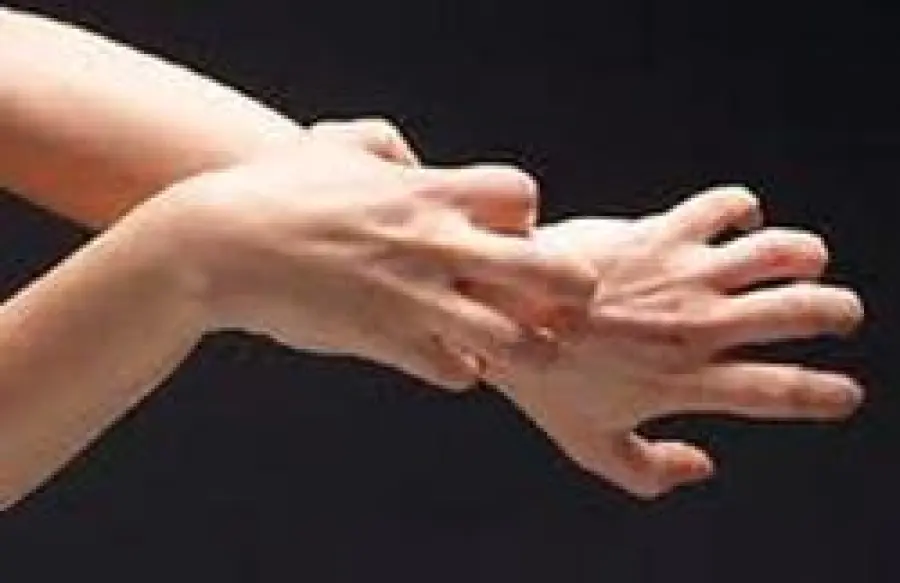 Cause orticaria: danni da abbronzatura, allergia ai farmaci, ai cosmetici, agli acari, alla tintura per capelli