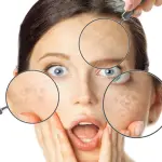 Crema schiarente per il viso: cosa è e come funziona