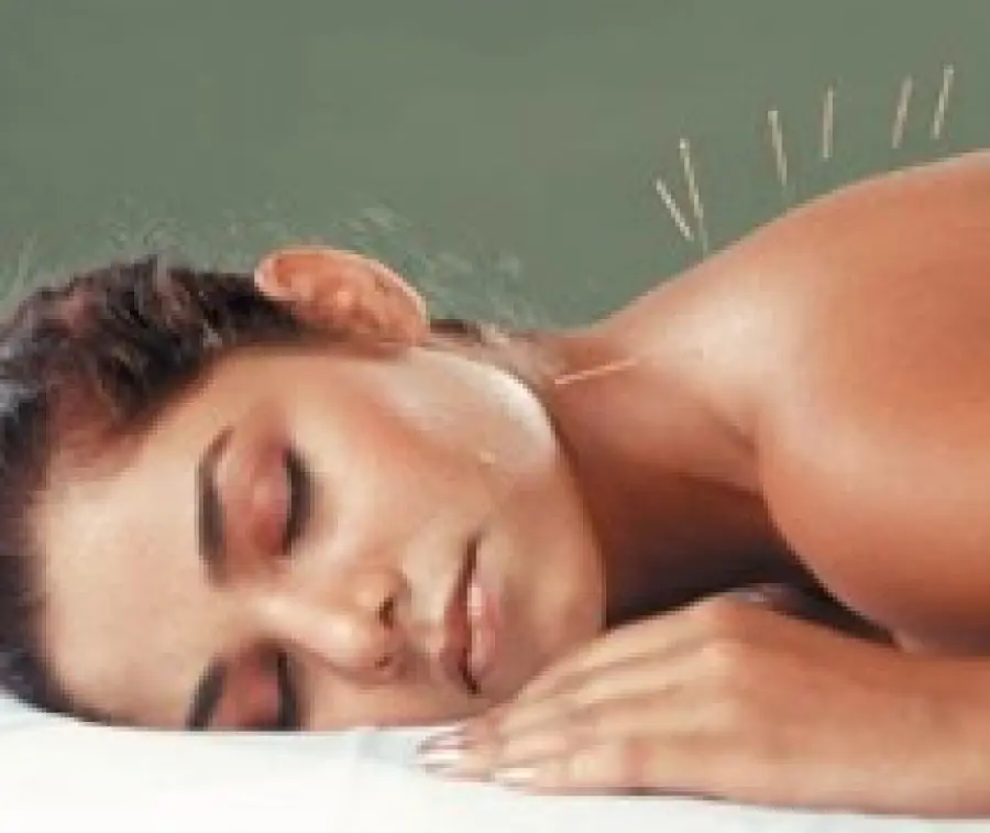 L' agopuntura per la cura dell' iperidrosi (eccessiva sudorazione dovuta a stress e ansia)