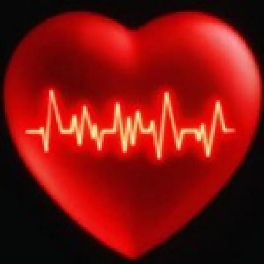 Defibrillatore sottopelle per la cura di aritmia cardiaca: fibrillazione e tachicardia ventricolare (malattie cuore)