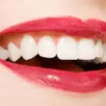 Laser antirughe per il contorno labbra e lipofilling per aumentare le labbra sottili