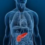 Sintomi tumore al pancreas e cura: intervento chirurgico, chemioterapia e rdioterapia