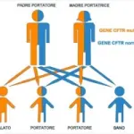 Il test del sudore per la diagnosi della fibrosi cistica. Sintomi fibrosi cistica - Malattie Genetiche Ereditarie