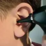 Sintomi e cura otite media catarrale, otite esterna, tappo di cerume nelle orecchie, calo dell' udito