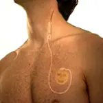 Nervo Vago e malattie del cuore: sintomi crisi vagale (pressione bassa e svenimento). Cura sincope vagale