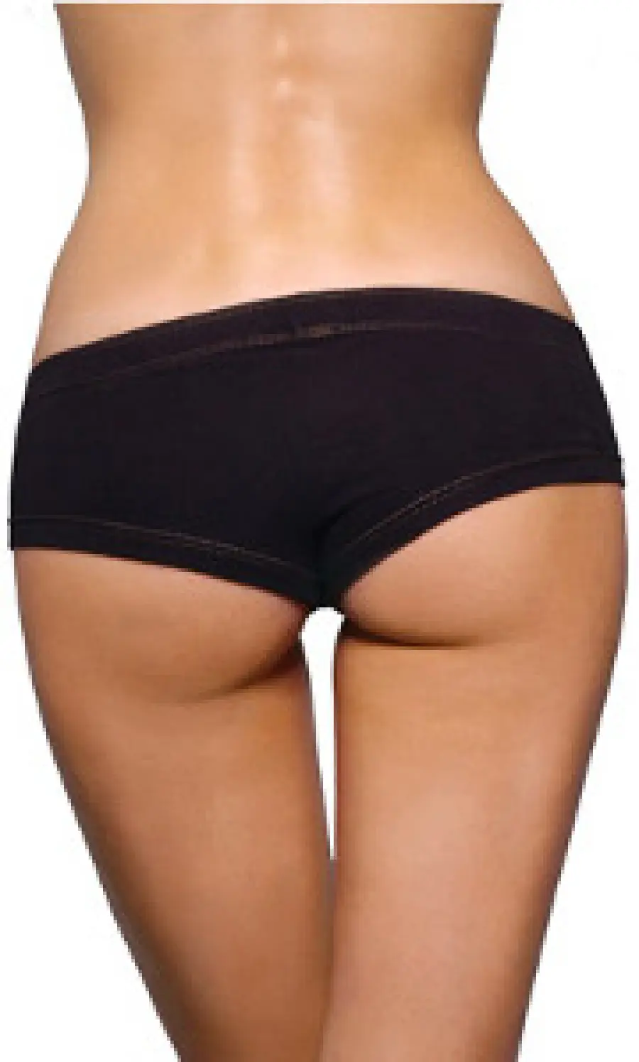 Eliminare le culotte de cheval (cuscinetti di grasso in eccesso sull' esterno coscia) con la medicina estetica