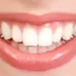 Rimedi naturali stomatite (infiammazione cavo orale-bocca): propoli, aceto di mele, olio di germe di grano