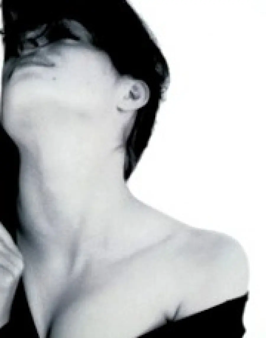 Laser antirughe per viso, collo e decollèté: trattamento antirughe criopass laser terapia - Medicina Estetica