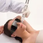 Rosacea sul viso: terapia di cura con il laser