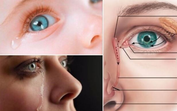 Eccessiva lacrimazione degli occhi: cura dell' epifora