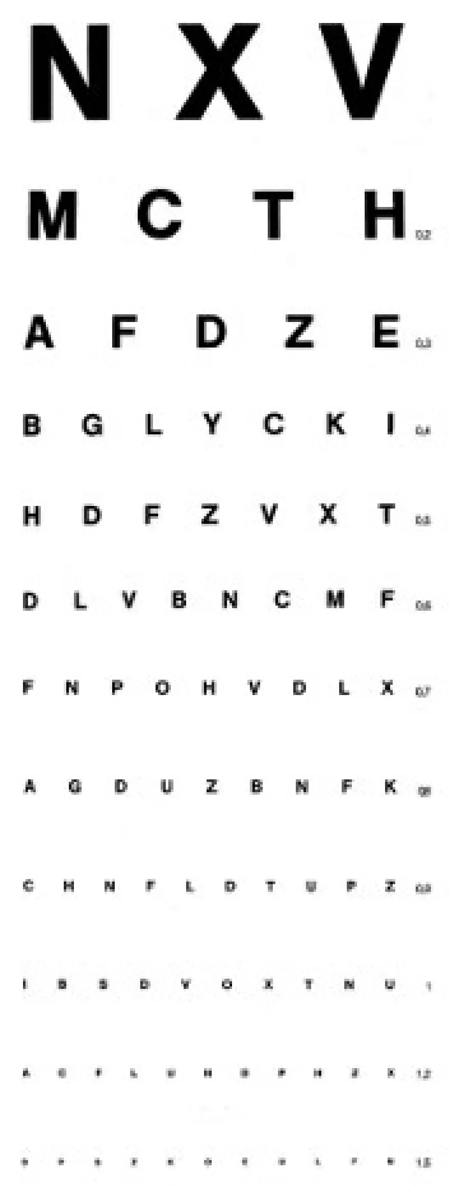 Difetti della vista: sintomi miopia, ipermetropia, astigmatismo, presbiopia, cataratta - Salute Occhi