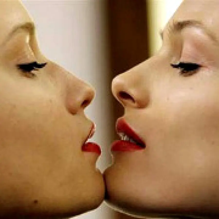 Laser frazionato antirughe e filler viso (iniezioni) di acido ialuronico per eliminare le rughe intorno alla bocca