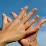 Rimedi omeopatici: le terapie di cura dell' omeopatia per la dermatite allergica da contatto. Pomate e granuli