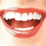 Salute e Bellezza dei denti: quando compaiono le macchie dei denti. Smalto dei denti e denti ingialliti