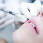 Filler Viso: acido ialuronico, collagene e botulino per eliminare le rughe del viso - Medicina Estetica Viso