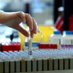 Nuovo punto prelievi a Bonola (Milano) del San Raffaele: analisi glicemia, virus HIV, epatire C, allergie specifiche