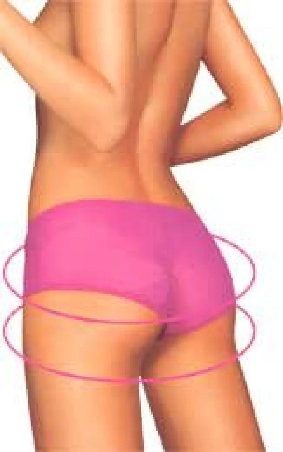 Liposuzione per eliminare il grasso in eccesso e lipofilling per aumentare i glutei piatti e poco sexy