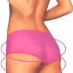 Liposuzione per eliminare il grasso in eccesso e lipofilling per aumentare i glutei piatti e poco sexy