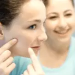 Indice glicemico, alimentazione e acne: troppi zuccheri sono causa di brufoli ed acne nei soggetti predisposti