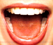 La lingua è lo specchio della salute: il check-up fai-da-te. Lingua bianca, afte, rischi del piercing sulla lingua