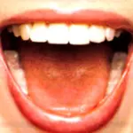 La lingua è lo specchio della salute: il check-up fai-da-te. Lingua bianca, afte, rischi del piercing sulla lingua