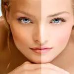 Il laser frazionato contro i danni da sole e abbronzatura: eliminare macchie della pelle e rughe del viso