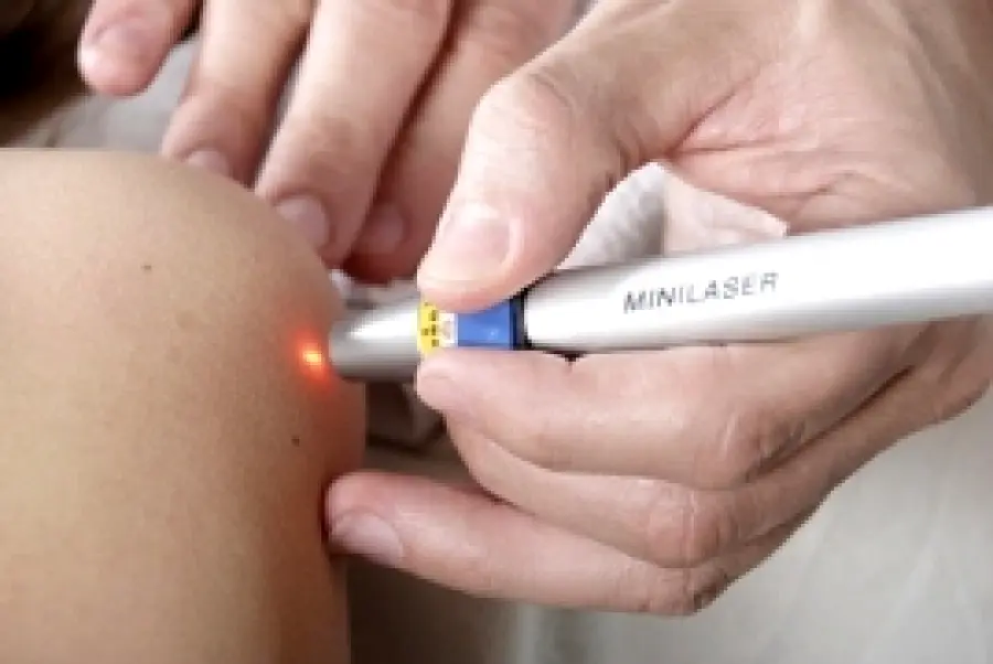 Trattamenti laser per eliminare macchie scure su viso e mani, capillari delle gambe, verruche seborroiche