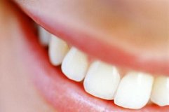Gengive e denti sensibili: non solo carie. I cibi che sensibilizzano i denti e corrodono lo smalto dei denti