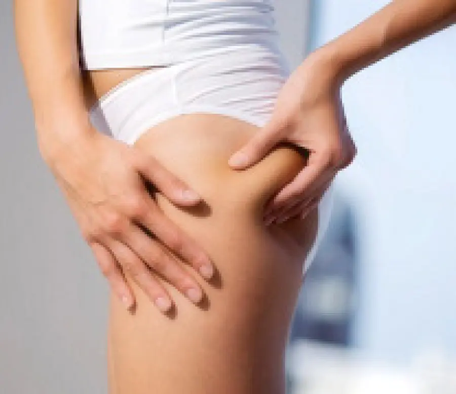 Onde d' Urto anticellulite: trattamento di Medicina Estetica per eliminare la cellulite fibrosa