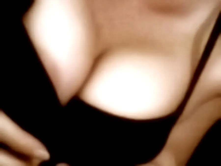 Biorivitalizzazione alle piastrine per ringiovanire décolleté  e parte alta del seno - Medicina Estetica Corpo