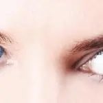 Filler al Collagene per eliminare occhiaie e borse sotto gli occhi. Iniezioni (Filler) - Medicina Estetica Viso