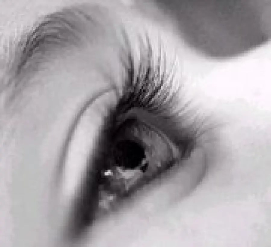 Chirurgia per la ricostruzione dell' occhio dopo un trauma, un glaucoma o un tumore agli occhi 