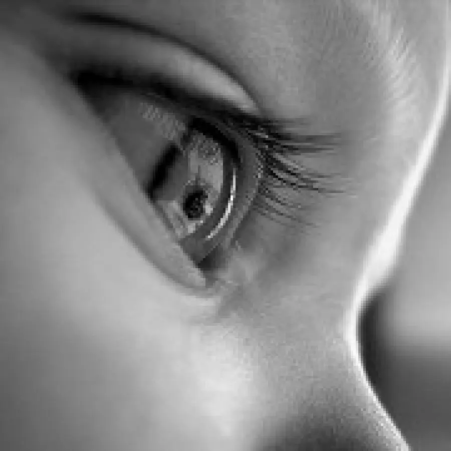 Difetti della vista - "Occhio pigro" nei bambini e salute occhi: sintomi, diagnosi e cura "occhio pigro" nei bambini 