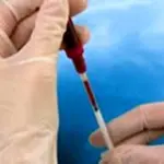 Epatite A, B e C ed Epatite Tossica (da intossicazione): sintomi epatite e cura - Malattie del Fegato