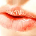 Herpes sulla bocca: rimedi omeopatici e cure per l' herpes da stress e da ciclo mestruale - Omeopatia