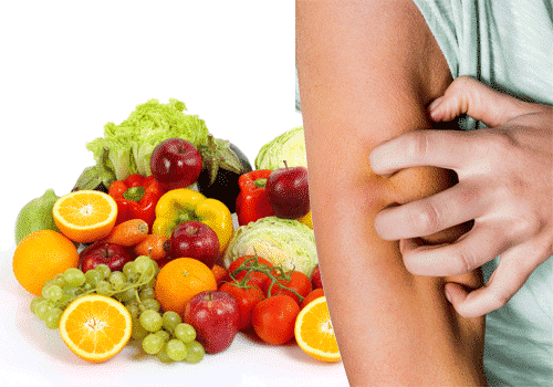 Psoriasi: dieta e alimentazione