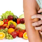 Psoriasi: dieta e alimentazione