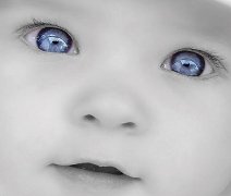 Cura della Ptosi congenita nei bambini: difetto della palpebra degli occhi che non si apre completamente