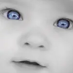 Cura della Ptosi congenita nei bambini: difetto della palpebra degli occhi che non si apre completamente