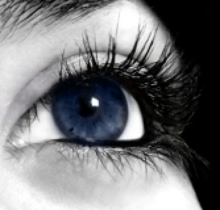 Blefaroplastica Superiore per le palpebre cadenti e Blefaroplastica Inferiore per le borse sotto agli occhi