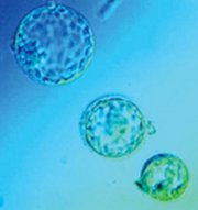 Le cellule staminali ricavate dal grasso corporeo di soggetti adulti per la rigenerazione dei tessuti