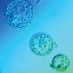 Le cellule staminali ricavate dal grasso corporeo di soggetti adulti per la rigenerazione dei tessuti