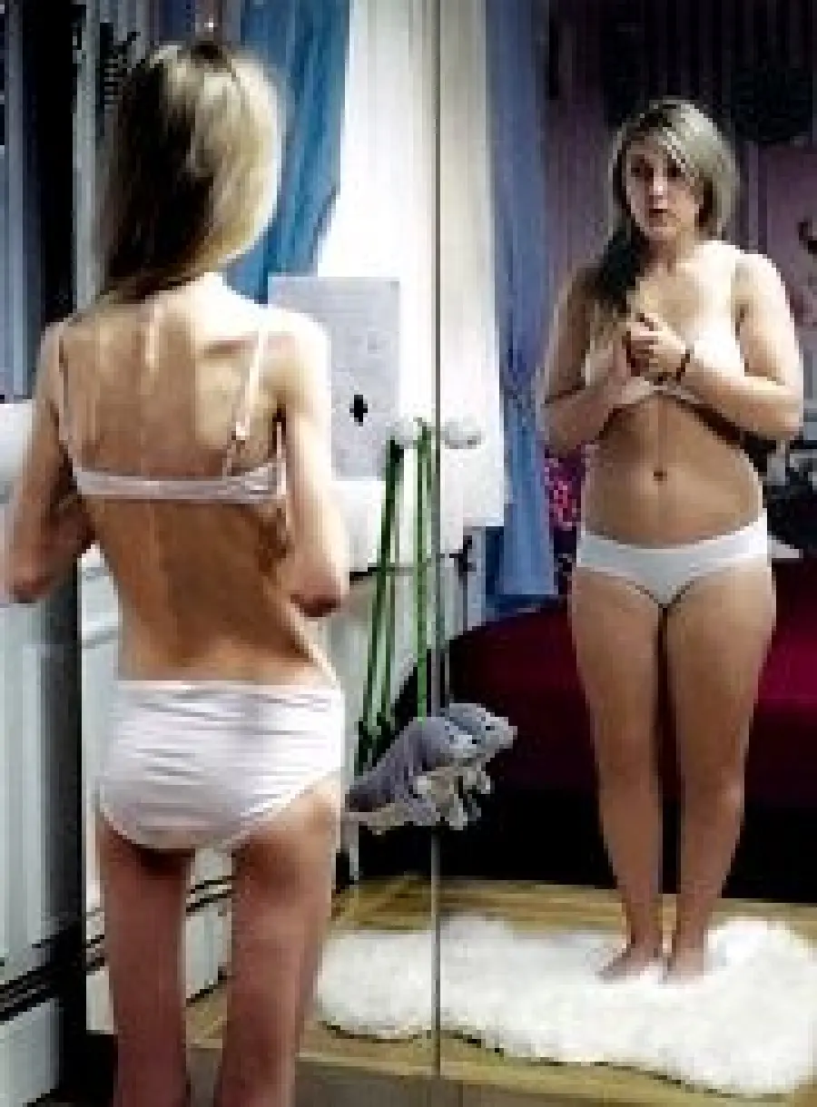 Progetto contro Anoressia e Bulimia in Italia: "Se ami qualcuno dagli peso". Capire i sintomi dell' anoressia 